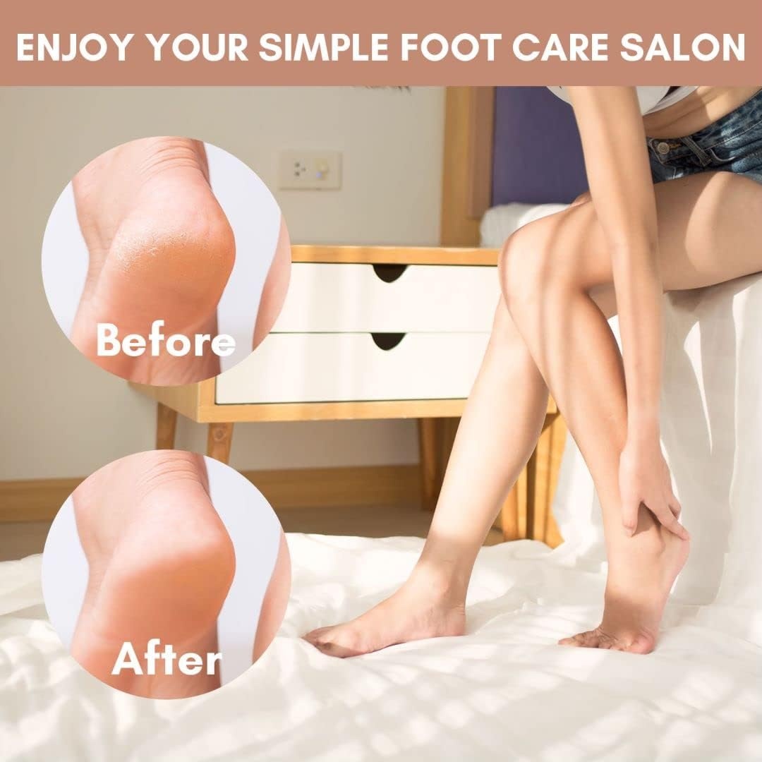image:imageMakartt Foot File Colossal Foot Scrubber Metal Foot Spa Pedicure Tools Callus Remover for Feet Dead Skin Care Removers Scraper Professional Rasp Callus Shaver RemovalBrown Foot File